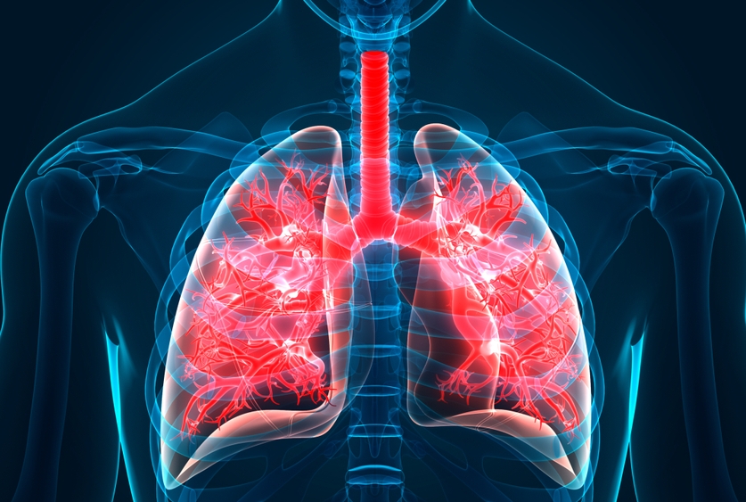 More Odds Of Advancing Idiopathic Pulmonary Fibrosis In IBD Patients