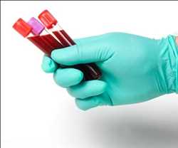 Global Blood Collection Market