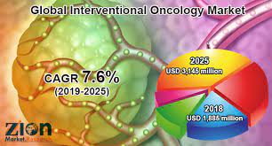 Global Interventional Oncology Market